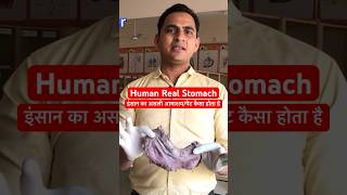 Human Real Stomach amp Acidity Problem  इंसान के असली पेट में छाले और ऐसिडिटी कहाँ होती है shorts [upl. by Wilen]