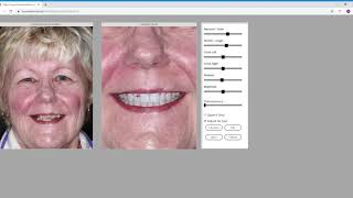 MySmileSim Tooth Library  Simulated Teeth [upl. by Vilhelmina840]