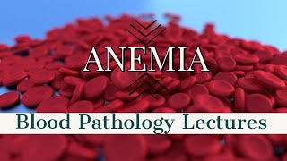 ANEMIA lecture 8 HERIDITARY SPHEROCYTOSIS in simple way [upl. by Ecnesse479]