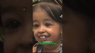 Jyoti Amge La Mujer más Pequeña del Mundo según Guinness RecordsAventura en la Grandeza Pequeña [upl. by Nealson]