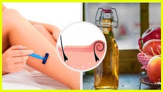 5 Natural Remedies for Irritation After Shaving [upl. by Romeu508]