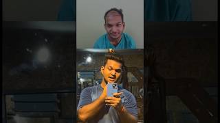 Big Dawgs  My Hair Transplant Before After Result in a minute shorts hairtransplant hairstyle [upl. by Darnell]