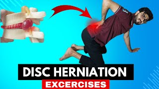 Effective Disc Herniation Excercises Relief Pain amp Restore your Movement [upl. by Ahseyn163]