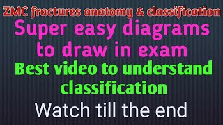 Zygomaticomaxillary complex fractures  anatomy amp classification [upl. by Belier961]