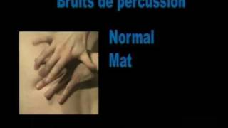 Percussion Savoir reconnaître la sonorité normale lors de la percussion dun thorax [upl. by Warwick]