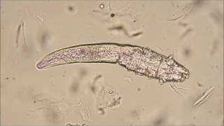 Demodex canis mites [upl. by Hildick475]