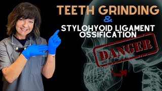 Teeth Grinding amp Stylohyoid Calcification  Dr Agatha Bis [upl. by Ayimat]