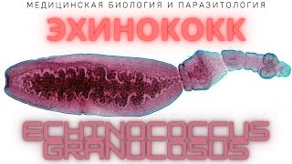 Эхинококк Echinococcus granulosus  Эхинококкоз Жизненный цикл Диагностика Профилактика [upl. by Eugeniusz447]