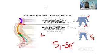 Spinal Cord lesion  Neurology lecture [upl. by Gustav212]