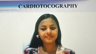 CARDIOTOCOGRAPHY FOR NURSES AND NCLEX EXAM [upl. by Eelanaj]