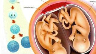 Everything You Need To Know About Fraternal and Identical Twins  Dr Sarah Finch [upl. by Milo146]