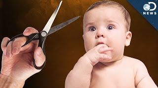 How Does Circumcision Affect Your Penis [upl. by Airehtfele961]