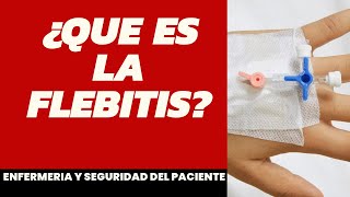 ¿Que es la flebitis enfermería [upl. by Judah108]