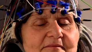 EEG  Elektroenzephalographische Untersuchung im nerv zentrum für neurologie Zürich [upl. by Flossy182]