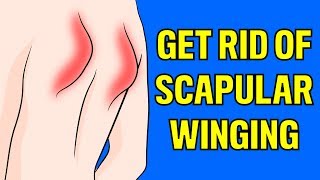 How to fix scapular winging FAST without equipment [upl. by Julissa995]