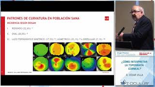 D César Villa ¿Cómo interpretar la topografía corneal [upl. by Inuat]