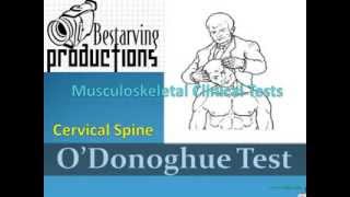 ODonoghue Test Musculoskeletal Clinical Tests [upl. by Nwahsyt]