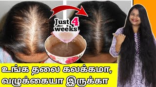 🔥JUST 4 WEEKS போதும்😱 வழுக்கையா தெரியுற உங்க தலையில் நெருக்கமா முடி முளைக்கும்  baldness tips [upl. by Eelirem]