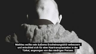 Selbstmord nach Haartransplantation [upl. by Afrika]