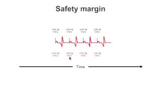 Pacemaker Issues Explained Part 1 Understanding Failure to Capture [upl. by Volnak]