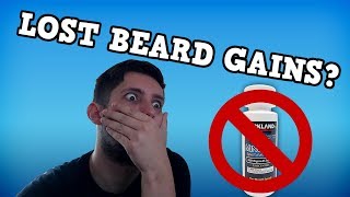 Minoxidil Beard Journey I Took A Break [upl. by Yentnuoc325]