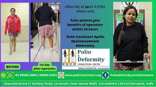 Both Genu Valgum  benefits of operation within 24 hours deformity treatment  bentknees [upl. by Dublin]