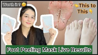 Foot exfoliating and peeling mask  best foot care  crack heel solution  crazy foot peeling 😍 [upl. by Melicent]