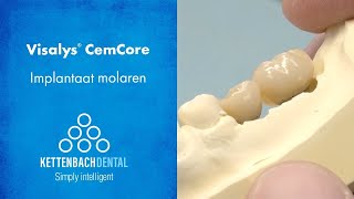 Visalys® CemCore als cementeercomposiet bij Implantologie [upl. by Yeldnarb]