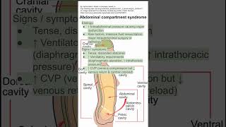 Abdominal compartment syndrome [upl. by Arella]