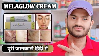 Melaglow cream uses benefits and side effects full review in hindi [upl. by Ittam815]