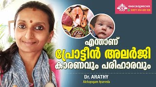 Protein Allergy Malayalam  Protein Allergy Symptoms Malayalam  പ്രോട്ടീൻ അലര്ജി  Dr Arathy [upl. by Logan]