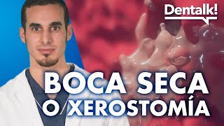 ¿Por qué tengo la BOCA SECA  Causas y tratamiento de la sequedad de boca o XEROSTOMÍA  Dentalk © [upl. by Cammie]