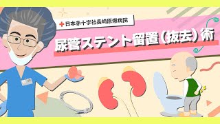 【日本赤十字社長崎原爆病院】尿管ステント留置術を受けられる患者様へ [upl. by Drue]