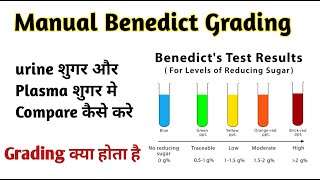 Benedict test grading [upl. by Thorny706]