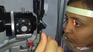 Laxmi Eye Education presents  Slit Lamp Examination [upl. by Plotkin464]