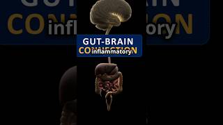 Gut health and Alzheimers alzheimers guthealth health medicine research [upl. by Fallon]