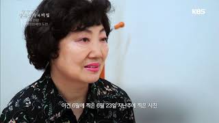 생로병사의 비밀  연간 7000만원이 드는 흑생종을 항암면역으로 치료한 김성자씨20180808 [upl. by Desi]