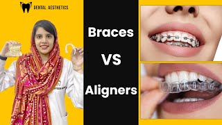 Braces VS Aligners Invisalign Which Is Better What Is the Best Way to Straighten Teeth [upl. by Dustan]