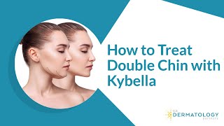 How to Treat Double Chin with Kybella [upl. by Durno]