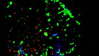 Movie 13 Directional extravasation of neutrophils from blood vessels toward the site [upl. by Elleinnod]