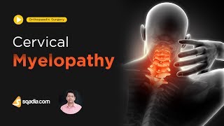 Cervical Myelopathy  Orthopaedic Surgery  Medical Student Lectures  VLearning [upl. by Eulau]