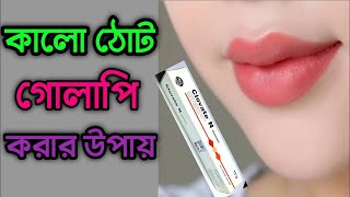 ঠোটের কালো দাগ দূর করার উপায় Tother kalo dag dur korar upay জেনে নিন কালো ঠোট গোলাপি করার ক্রিম [upl. by Yrrot335]