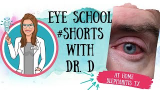 At Home Blepharitis Treatment  SHORTS [upl. by Antons53]