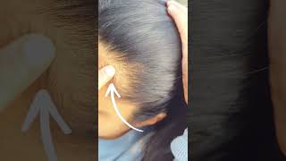 3 Tips that can Fix your RECEDING HAIRLINE  Receding Hairline TRANSFORMATION [upl. by Rubenstein]