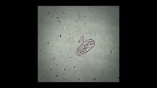 A Strongyloides spp egg in the faeces of cattle [upl. by Gemini]