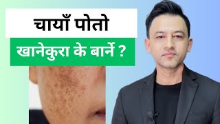 Foods to avoid in Melasma  Dr Prakash Acharya [upl. by Nomzaj433]