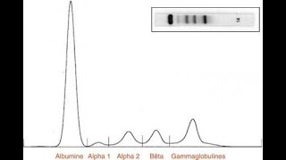 Electrophorèse des protéines sériques [upl. by Marra531]