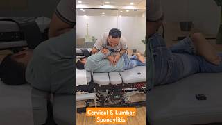 Cervical and Lumbar Spondylitis Treatment in India DrMushtaque 🇮🇳 chiropractor Migren sciatica [upl. by Enamrahc]