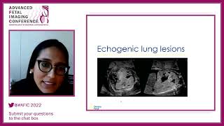 Overview of Fetal Thoracic Pathology  Dr Nimrah Abbasi  Advance fetal Imaging Conference [upl. by Tobiah]