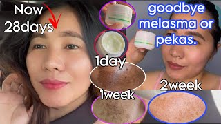 GOODBEY MELASMA OR PEKAS TREATMENT EXPERIENCE 100 MURA AT EPEKTIBO NA CREAM IN JUST 28DAYS [upl. by Zipnick195]